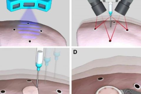 《Science》子刊：在活體器官上原位3D打印可變形水凝膠傳感器！