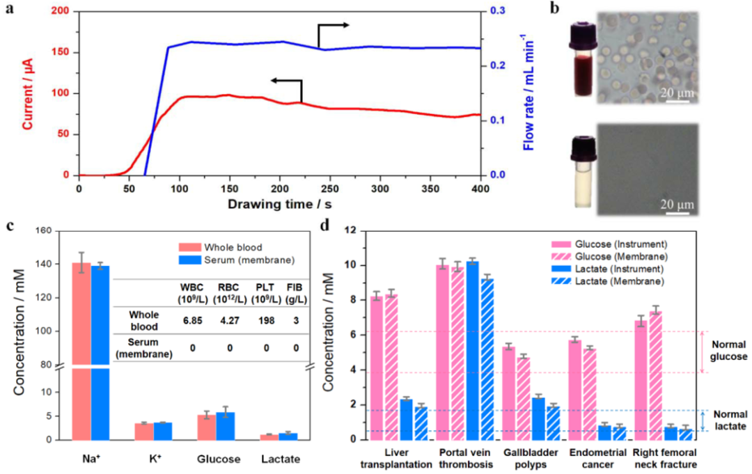 南京工業(yè)大學(xué)金萬(wàn)勤教授《Angew》：僅需1分鐘！新型分離傳感膜實(shí)現(xiàn)實(shí)時(shí)高效血清分析！