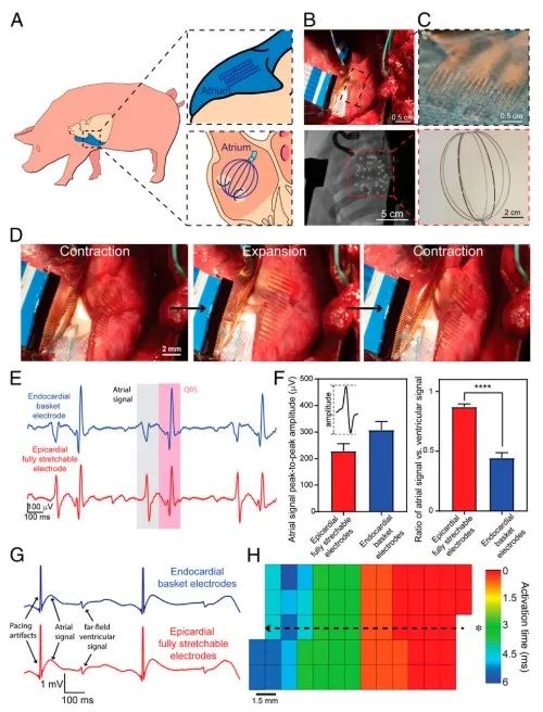 斯坦福大學(xué)鮑哲南團隊：柔性電子新突破！細胞級分辨率心電監(jiān)測，守護人類健康