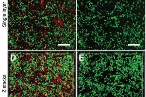 新加坡國立大學(xué)《AFM?》：肉眼可見！共軛低聚電解質(zhì)助力革蘭氏細(xì)菌的區(qū)分