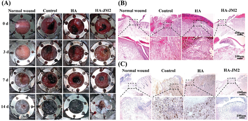 不懼腫瘤術(shù)后復(fù)發(fā)！上交大李海燕《AFM》：用于內(nèi)部組織修復(fù)和抗術(shù)后粘連的Janus水凝膠濕粘合劑，