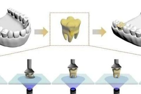 強(qiáng)大，一滴樹脂就能打印一顆牙齒！中科院化學(xué)所實現(xiàn)單液滴3D打印技術(shù)