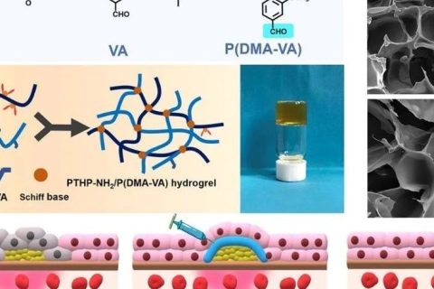 青島大學(xué)叢海林教授：原位注射聚四氫嘧啶自愈合抗菌水凝膠治療化膿性皮下感染